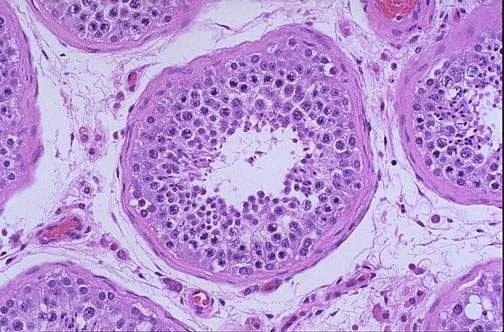 Testes onder de microscoop Sperma onder de microscoop